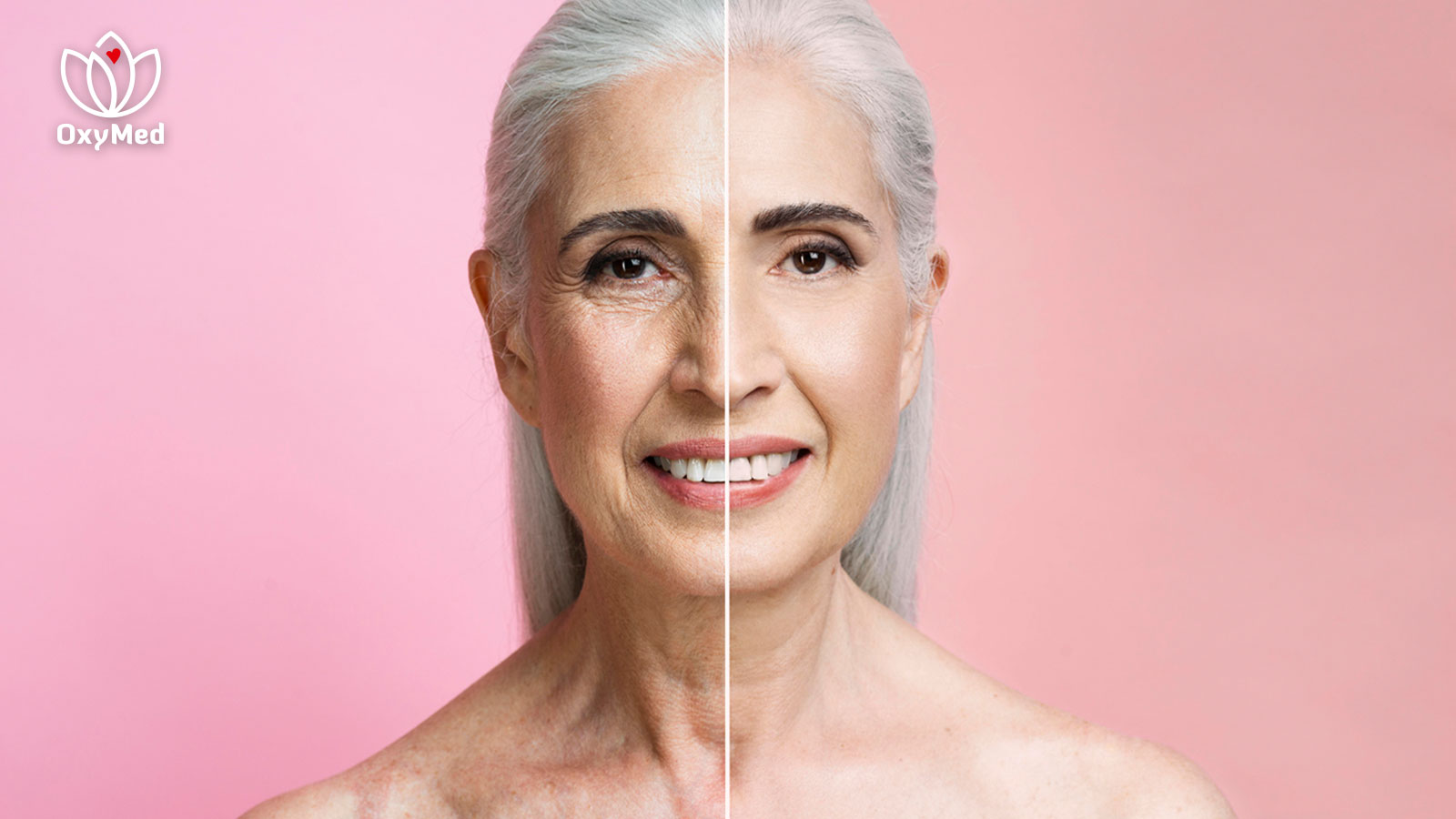 Terapia anti-aging